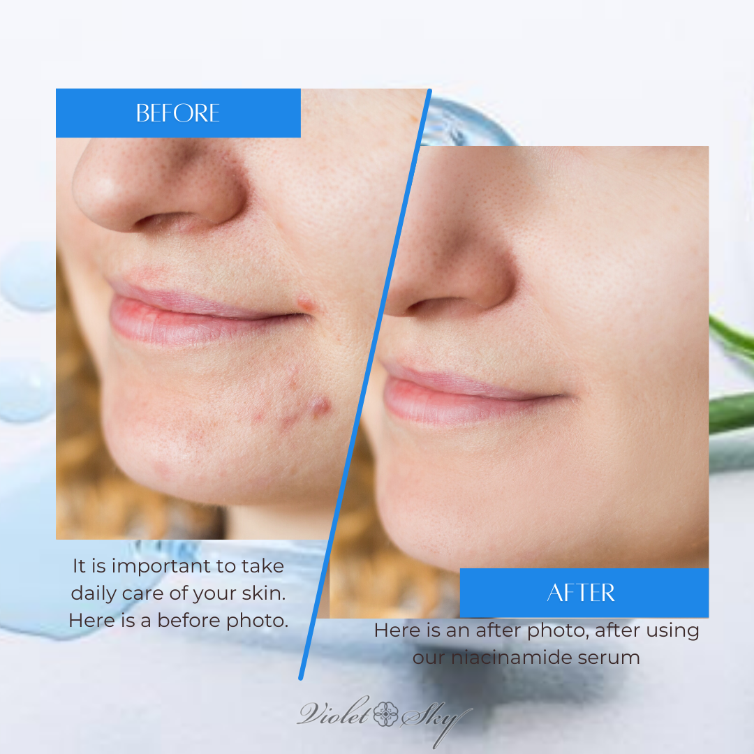 Niacinamide 10%, Copper & Zinc Concentrated Serum