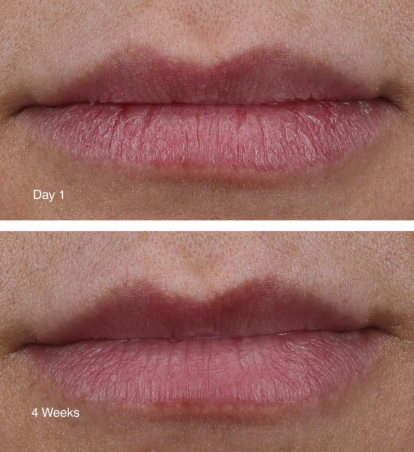 Peptide Lip Treatment- unscented